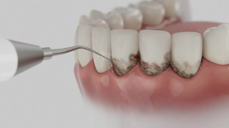 Reliable Dental contractor in Macungie, PA by Smile Center Dentistry